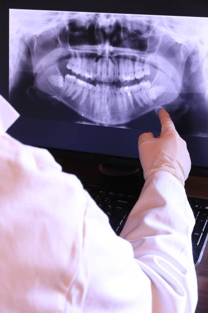 Best Emergency Denture Repair in Lutherville, MD