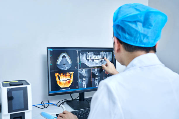 Best Emergency Root Canal Treatment in Lutherville, MD