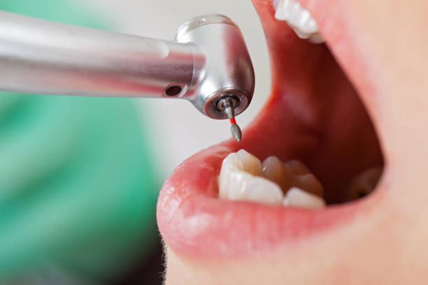 Best Emergency Gum Treatment in Lutherville, MD